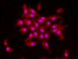 Visualización con microscopio de fluorescencia de la proteína DDR1 en células humanas productoras de mielina. La proteína DDR1 se detecta con quatum dotes que emiten fluorescencia de color rojo. El núcleo se visualiza con un colorante fluorescente.